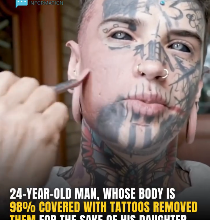 24-Year-Old Dad Removes All His Tattoos for His Daughter – The Transformation Is Stunning