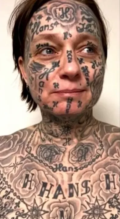 Woman Removes 250 Tattoos Of Her Ex’s Name All Over Her Body, Stuns Internet With Her Transformation